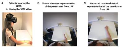 Changing Body Representation Through Full Body Ownership Illusions Might Foster Motor Rehabilitation Outcome in Patients With Stroke
